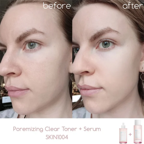 سرم آمپول جمع کننده منافذ سنتلا SKIN1004 Madagascar Centella Poremizing اصلی سلین بیوتی
